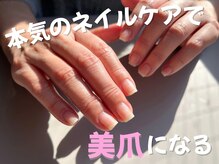 ビジュー ネイル(Bijoux)の雰囲気（ささくれ/割れやすい等。爪専門家によるネイルケアでお悩み解決）