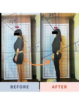 しろくま整体院 鷺ノ宮阿佐ヶ谷院/結婚式を控えてる方へ♪