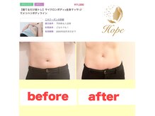 ホープ(Hope)の雰囲気（夏に向け気になる部位の引き締めに！筋トレマシーン後の変化♪）