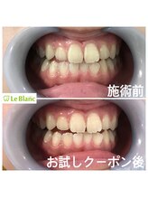 ルブラン 奈良店(Le Blanc)/学校帰りにがんばります！！