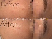 ローズリリー 名古屋店(Rose Lily)/