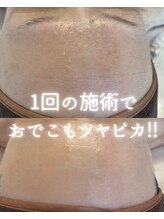 リルビー(Lilby)/ハーブピーリング・艶肌wax