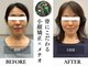 カドル 新宿店(KADORU)の写真