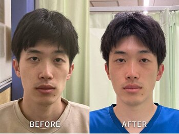 整音(totonone)/面長、左右差矯正