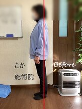 たか施術院/肩こり 背中の痛み