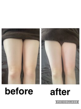 ギンザアール(GINZA R.)/下半身集中！