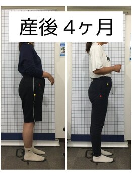 トータルケアサロンコヤマ 武庫之荘院(KOYAMA)/骨盤矯正