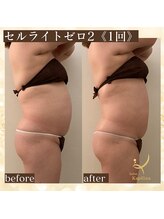 サロン カピリナ(salon Kapilina)/【before→after】