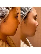 凪 横浜/マリコール