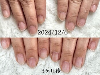 グレースレディ 神戸北店/