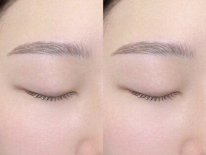 キラアイビューティー 静岡(killa eye beauty)の写真