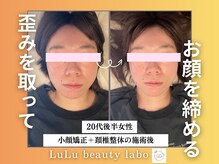 ルルラボ(LuLu beauty labo)/整った顔は印象が違う！