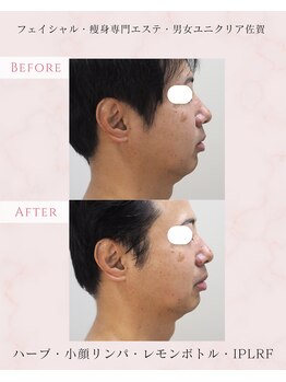 ユニクリア(Uni clear)/佐賀市│小顔・美白リフトアップ
