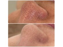 エステティック トリートメント クオリティ(Esthetic Treatments Quality)の雰囲気(しつこく、深まる毛穴悩み。毛穴は“隠す”から“変える”へ!)