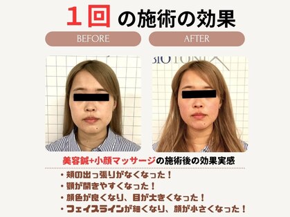 クローバー鍼灸整骨院の写真