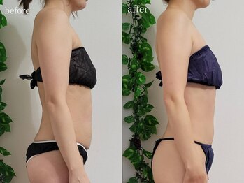 ティティビューティ ラ・クエージ金山(TTBeauty)/