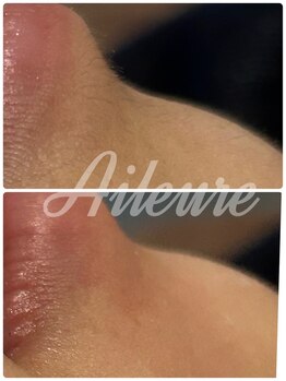 エルール トータルビューティ(Aileure total beauty)/Waxフェイシャル