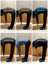 アクア∞リング/ビフォーアフター3ヶ月