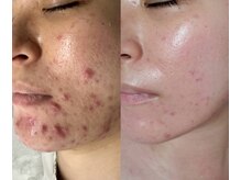 一度の施術で効果を実感できるメニューが豊富