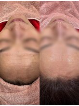 アース オーセンティック 新浦安店(EARTH Authentic)/【潤艶Wax×美容液導入】