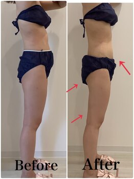 スペチアーレ 夙川/小顔と美ボディGET