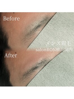 サロンロン 横浜関内(SALON RON)/メンズ眉毛/美容電気脱毛