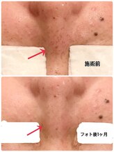 レイール(Reir)/フォト美顔