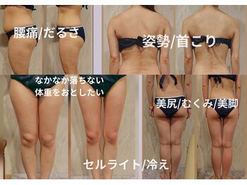 カルナボディ(Carna body.)の写真/話題のハイパーナイフ６ならではの効果◎体重を落としながらボディラインを整えたい方！短期集中痩身も可能
