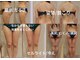 カルナボディ(Carna body.)の写真/話題のハイパーナイフ６ならではの効果◎体重を落としながらボディラインを整えたい方！短期集中痩身も可能