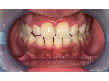 セルフホワイトニング・脱毛サロン　PLEAGE【プレアージュ】の雰囲気（ホワイトニングの症例写真はフォトギャラリーをCheck！）