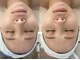 ビビディ(Bividy)の写真/【ブライダルエステにもおすすめ◎】”コルギ”を試してみたい！という方大歓迎♪匠の技でお応えします