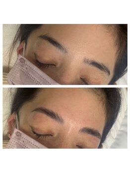 ラ フルール(La Fleur)/ハリウッドブロウリフト