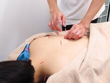 グッバイ鍼灸院整骨院整体院(good bye鍼灸院整骨院整体院)/鍼施術