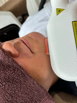 アナベルプラス(ANABEL+)の写真/【メンズ大人気！お手軽価格でお顔・ひげ脱毛★初回顔各パーツ¥2000】お顔全体トーンUP&清潔感UPで垢抜け！