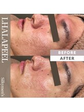 ユーフォリアファステ シルキーメンズ(Euphoria Faste Silky Men's)/男性にもオススメ◎