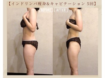 オキシー グレイス 黒崎店(OXY Grace)/ブライダルでご来店のお客様♪