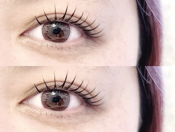 エム アイデザイン(M.eyedesign)/＆healthy＋Wフラット100本