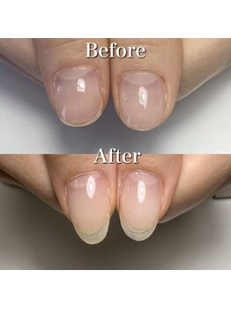 リリー/自爪育成サロンに通ってた方も