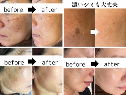 パールホワイトニングサロン 茅ヶ崎店の写真