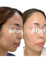 フジモトサロン 那覇おもろまち店(fujimotoサロン)/使い続けた結果が、これ