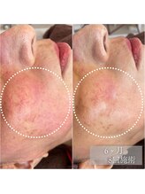 アイビーケア 三田(ivy care)&nbsp;肌管理フェ イシャル