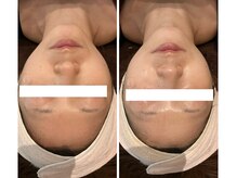 チェンジ 小山店(Change)/