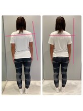 エーピラティス 美生体研究所(A pilates)/初回1回のみの姿勢変化(^^)