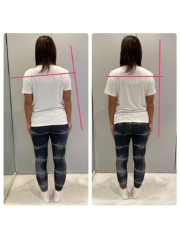 エーピラティス 美生体研究所(A pilates)/初回1回のみの姿勢変化(^^)