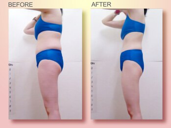 ジュリア オージェ 四条河原町店/ビフォーアフター（ターゲット）