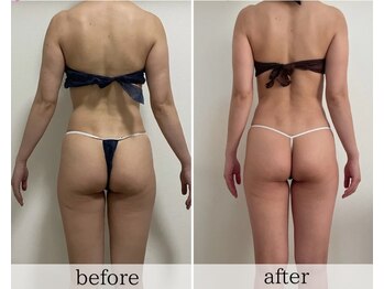 リュクス(LUXE)/40代からの美body作り