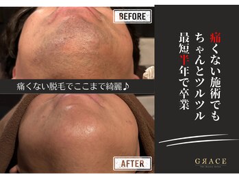 グレイス 久留米店(GRACE)