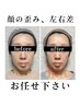 ☆人気No.１☆【矯正×オイル×美顔器】Qpuプレミアムフルコース¥20,900→