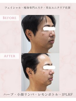 ユニクリア(Uni clear)/見た目の印象が変わる!