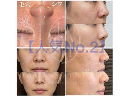 多穏スキンケア(skin care)の写真